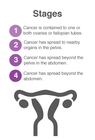 Ovarian Cancers/Tumors - Ovary